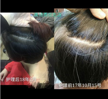 美诗秀消费者案例