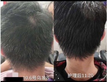 美诗秀消费者案例