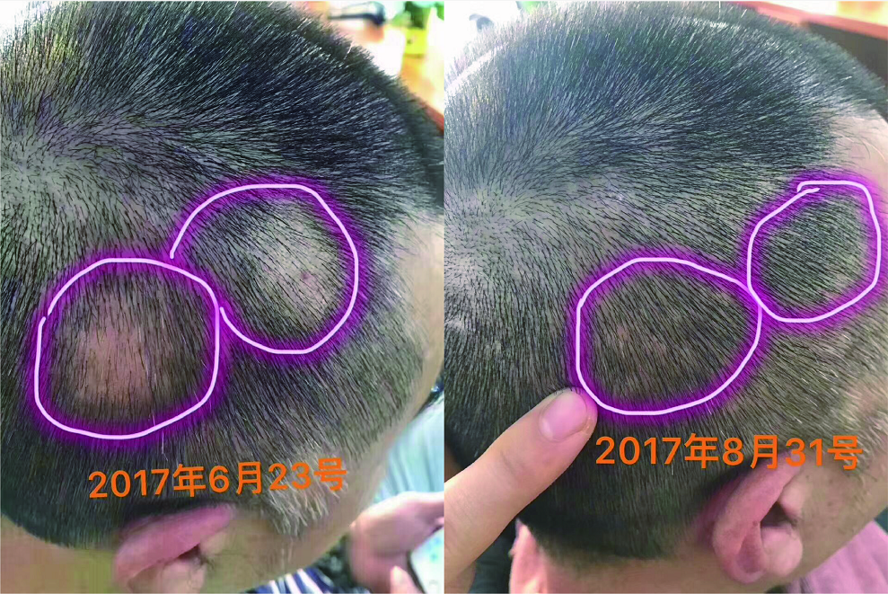 美诗秀消费者案例